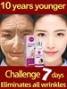 Anti-wrinkle Serum Remove Face Neck Forehead Wrinkles Anti-aging Skin Firming Products 1