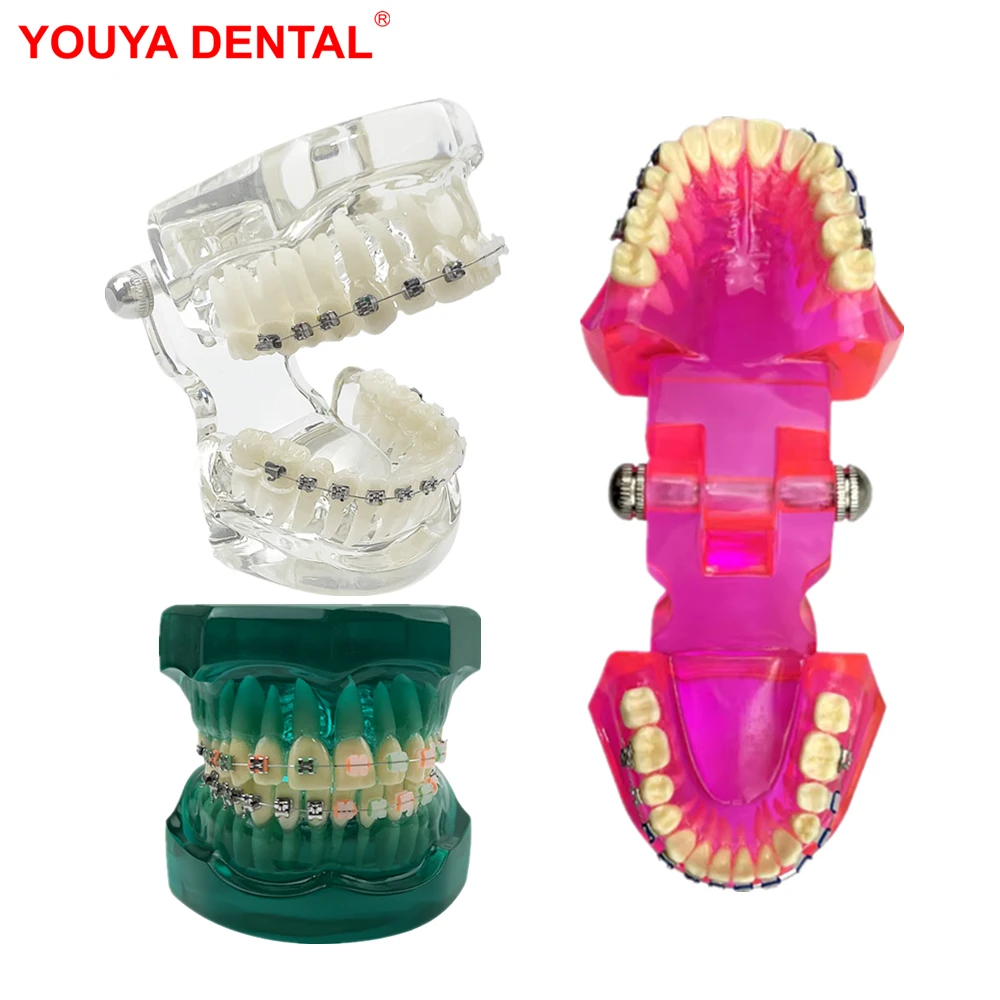 치과 교정 모형 타이포돈트 반금속 반세라믹 교정 치아 모형 학습 교육 환자 교..