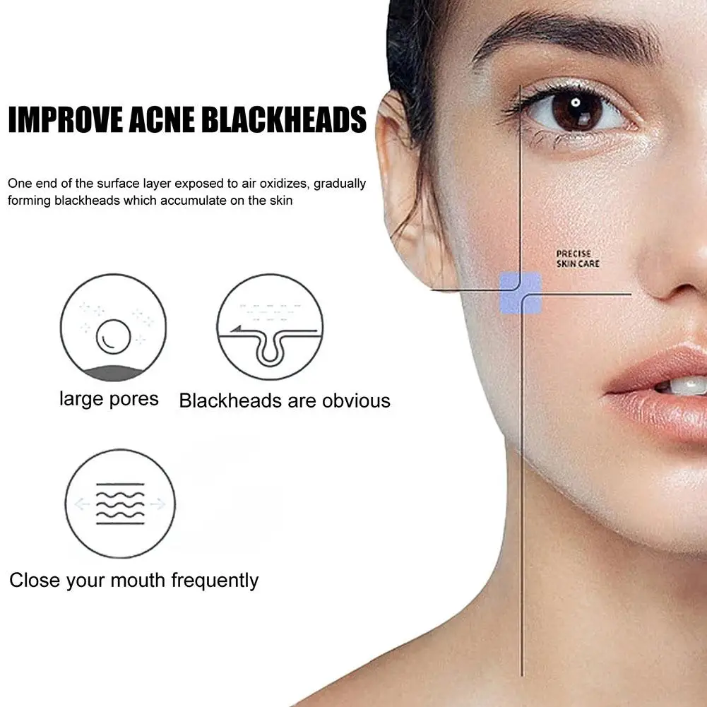 LANBENA New Style Blackhead Remover Nose Mask Pore Strip Black Mask Peeling Acne Treatment Black Deep Cleansing Hudpleje Korea_voghion.com