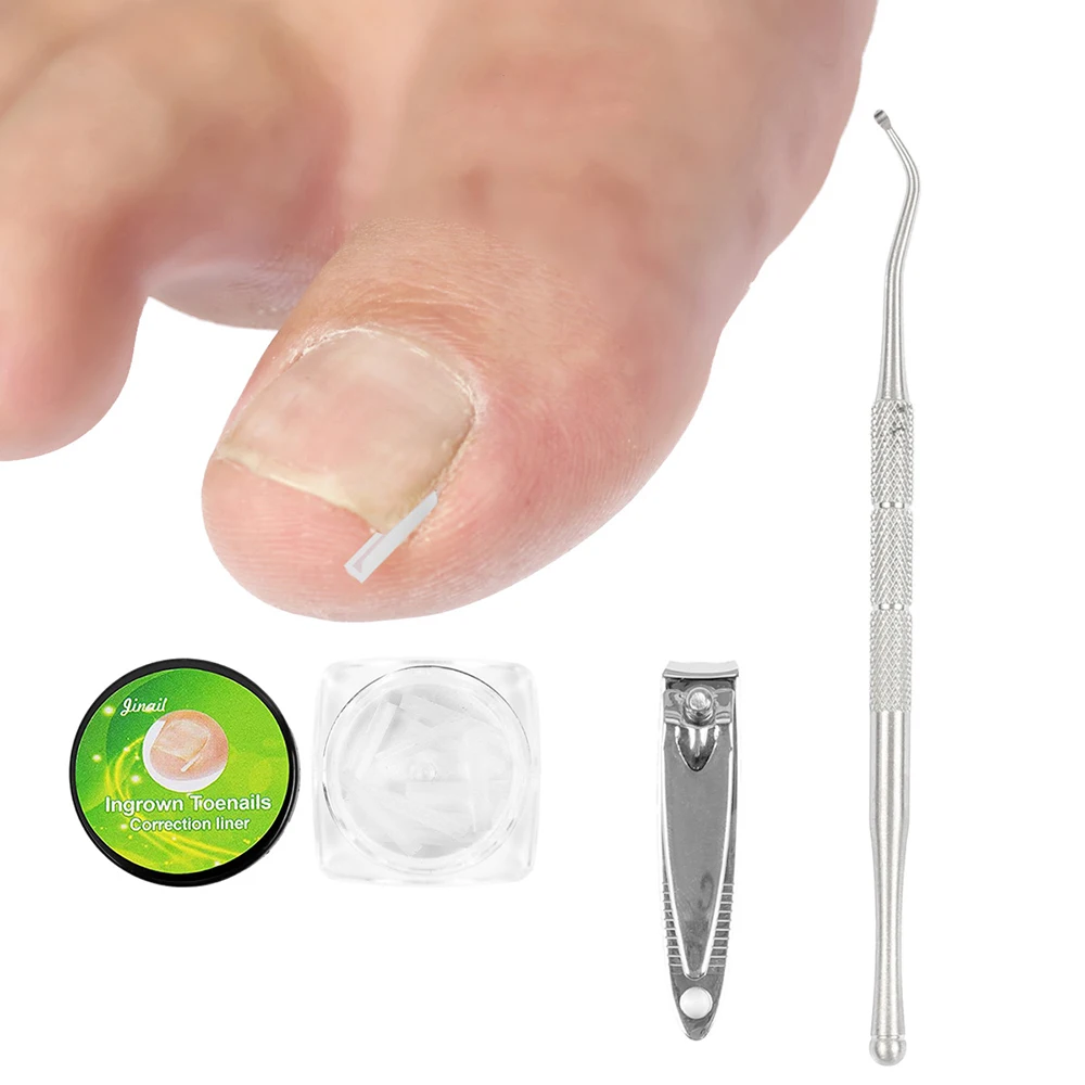 1020pcsIngrownNailPadSetFillingGroovePadToenailCorrector