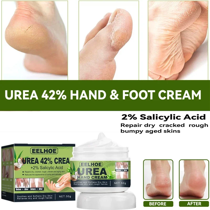 

Herbal Anti Crack Foot Cream Anti-Drying Heel Cracked Repair Calluses Dead Skin Removal Foot Mask Moisturizing Hand Feet Care