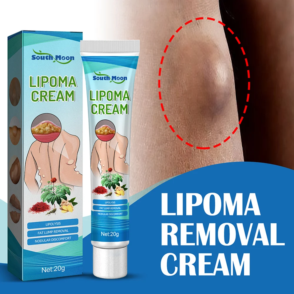 

20g Lipoma Remove Cream Natural Herbal Relieve Fat Lumps Subcutaneous Fibroid Removal Reduce Inflammation Body Facial Care