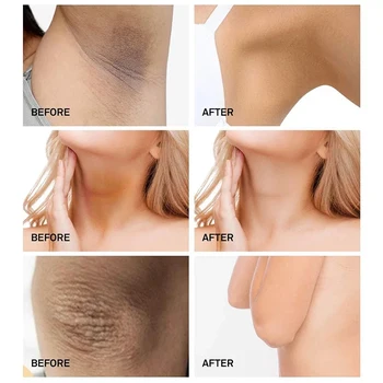 7days Body Whitening Cream Underarm Armpit Knee Dark Spot Cream Skin Brighten Moisturizing Body Care Cosmetics for Women Men 3