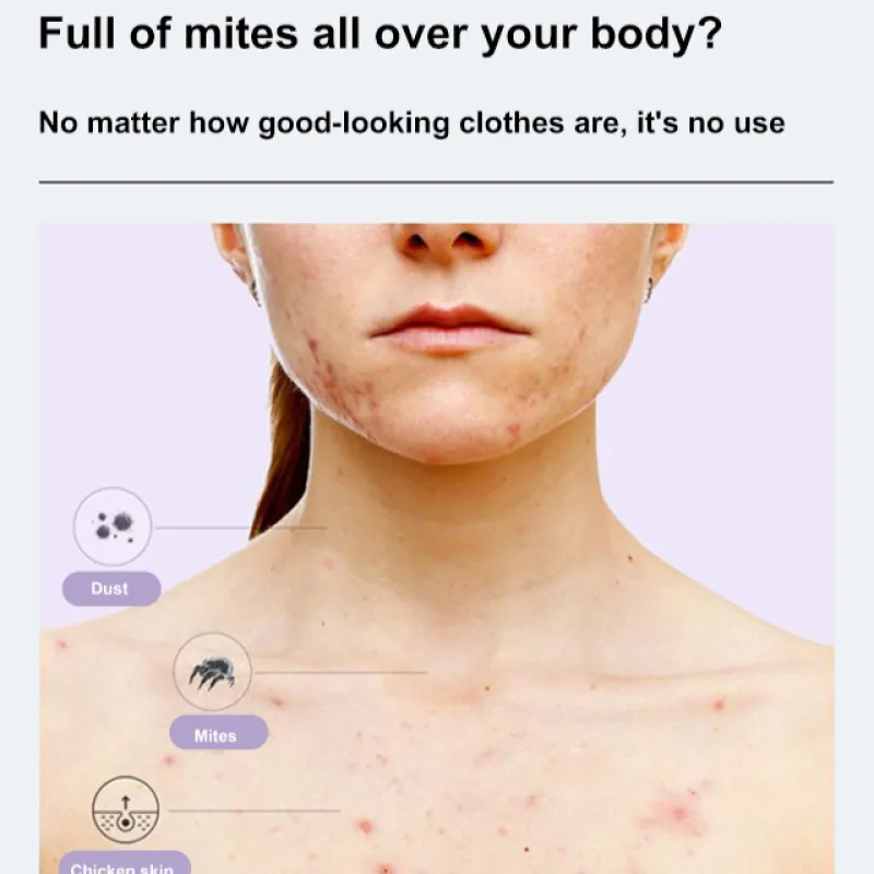 Sulfur Mite Removal Shower Gel