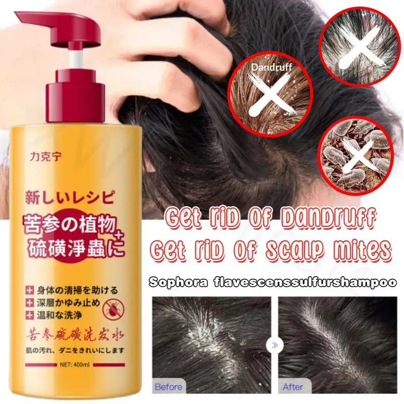 

Improve Itchy Scalp Relieve Rough Hair Sophora Flavescens Anti-mite Anti-dandruff Anti-itch Oil Control Sulfur Shampoo 400ml