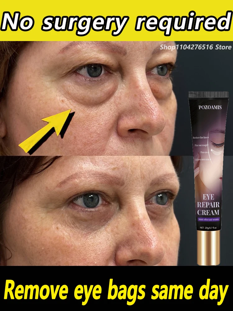 Eye bags remover eye bags are a thing of the past youth is still handsome
