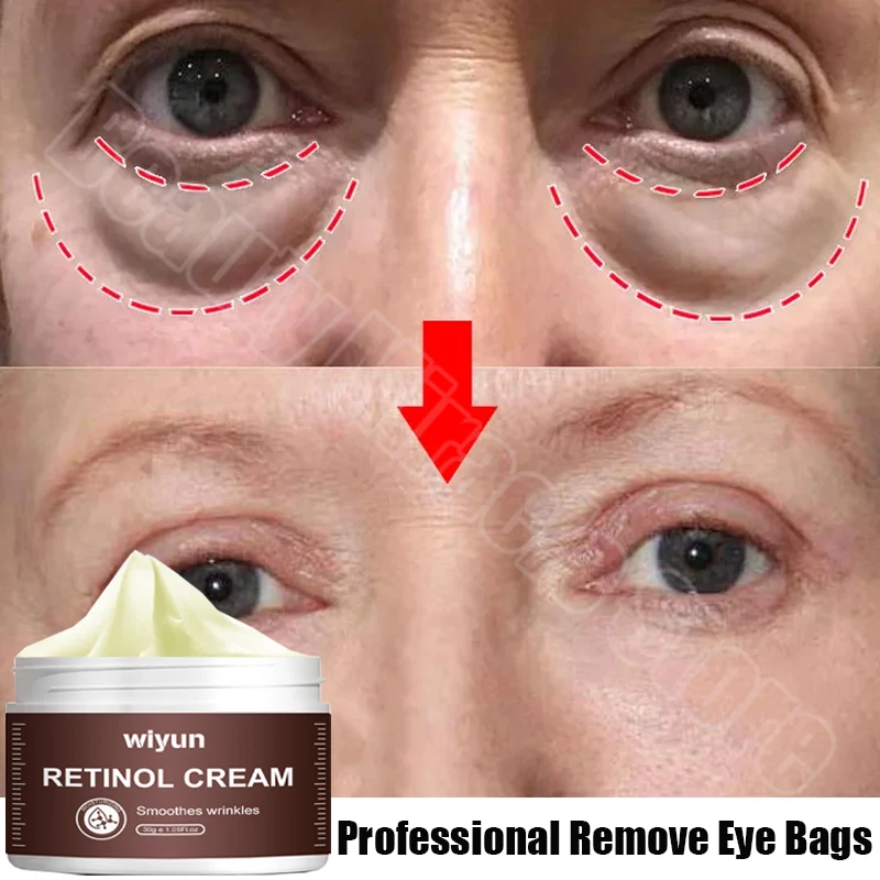 

Instant Eye Bag Removal Cream Retinol Remove Wrinkles Firming Skin Fade Fine Lines Brighten Dark Circle Anti Puffiness Korean