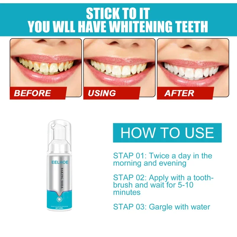 Dental Calculus Remover Whitening Teeth Mouth Odour Removal Bad Breath Preventing Periodontitis