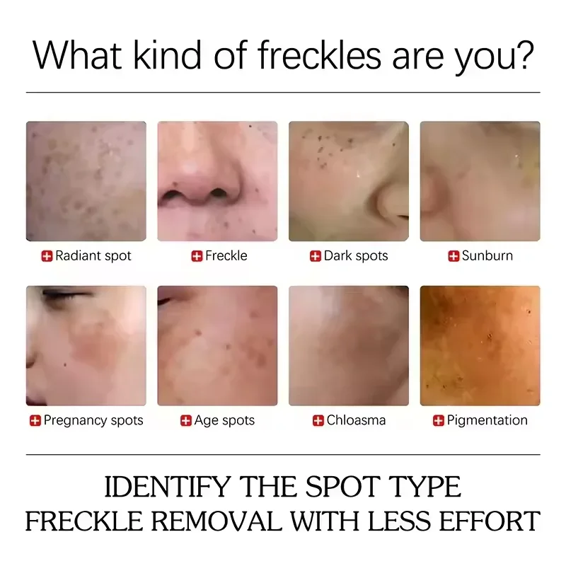 Whitening Freckles Face Serum Effective Remove Dark Spots Fade Melanin Improve Dullness Brighten Repairing VC Skin Care Product