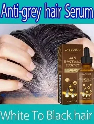 YH03 tueur de cheveux blancs cheveux blancs à noirs traitement de sérum d'essence de cheveux Anti-gris restaurer la couleur naturelle des cheveux et restaurer la santé 1