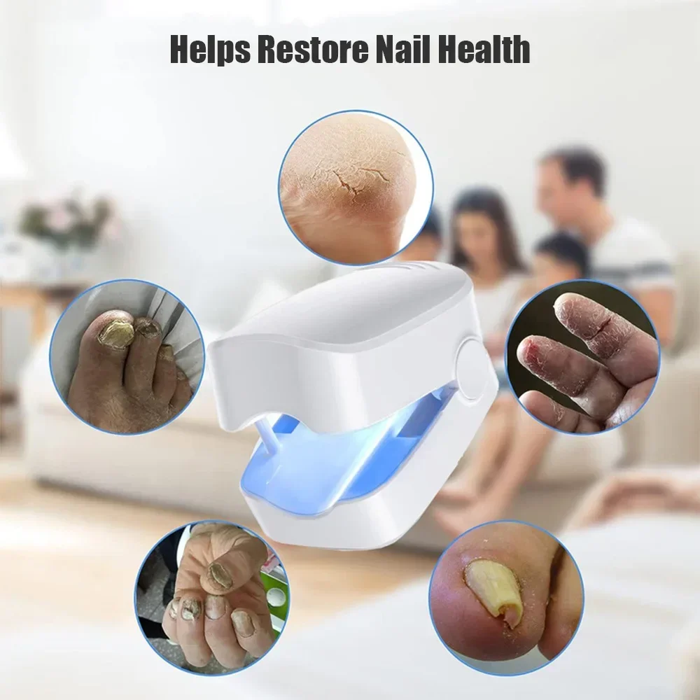 Nail Fungus Laser Treatment Device Repair Toenail Fingernail Fungus Treat Onychomycosis Therapy Cure Machine Effectively Remove nail fungus remover