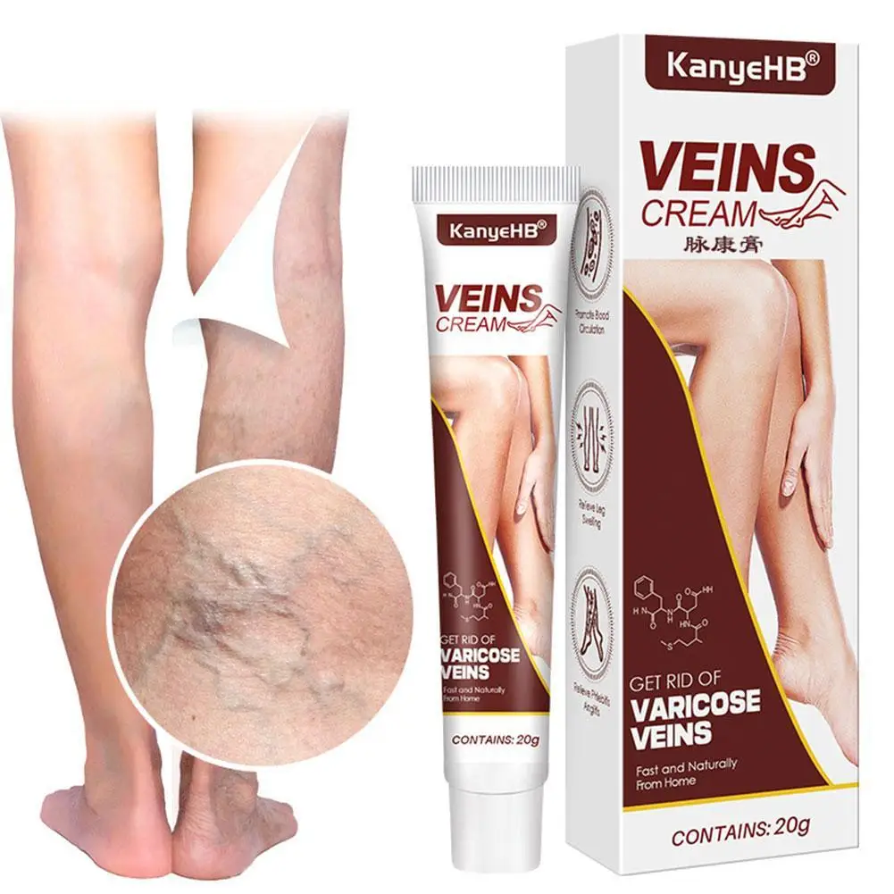 

Varicose Vein Treatments Cream Effective Relieve Legs Dilated Vasculitis Phlebitis Spider Legs Natural Formula Ointment