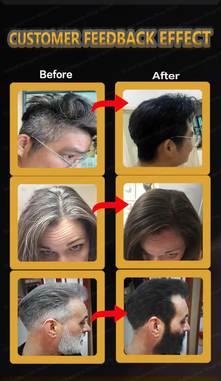 Description Picture 4 of itemAnti Gray Hair Serum Remedy White Darkening