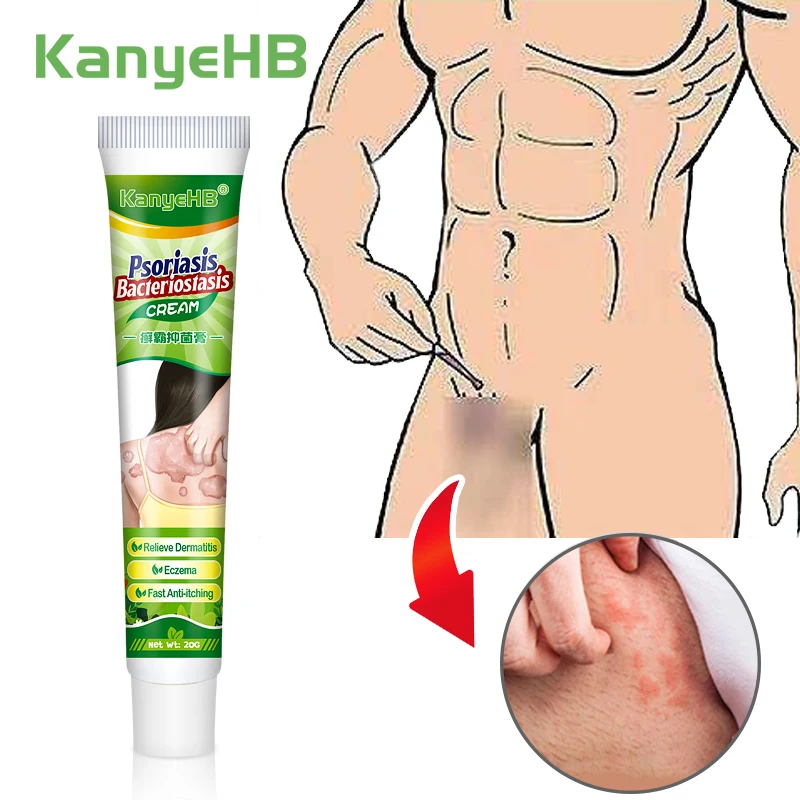 1pcs Private Part Anti-itch Cream Anal Itching Cream Psoriasis Glans Penis Itch Scrotal Eczema Odor Antifungal G024