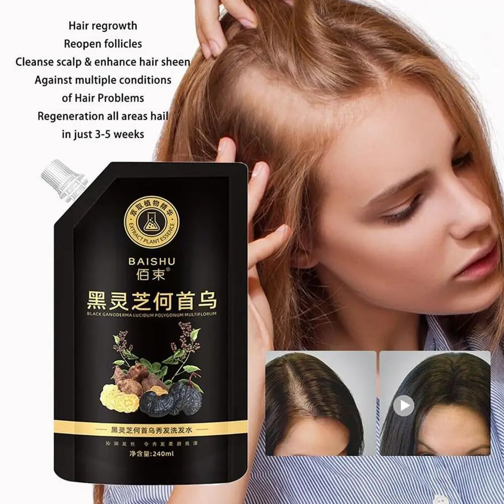 Multiflorum Hair Shampoo 240ml He Shou Wu Shampoo Grey Reverse Shampoo Black Hair Shampoo For Natural Deep Cleasing Gray Ha D8L5