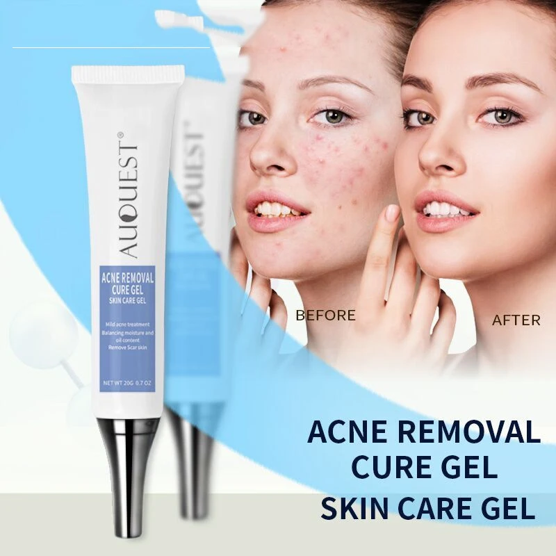 

3PCS/LOT LAUQUEST Herbal Acne Treatment Cream Pimple Spot Removal for Teens Oil Control Acne Scar Shrink Pores Skin Care Beauty