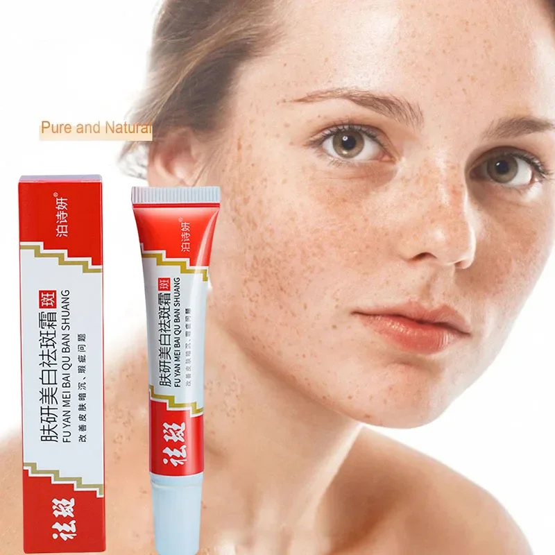 

Freckle Whitening Cream Black Dots Melasma Remover Anti Brown Stain Lighten Pigmentation Moisturizing Korean Skin Care Products
