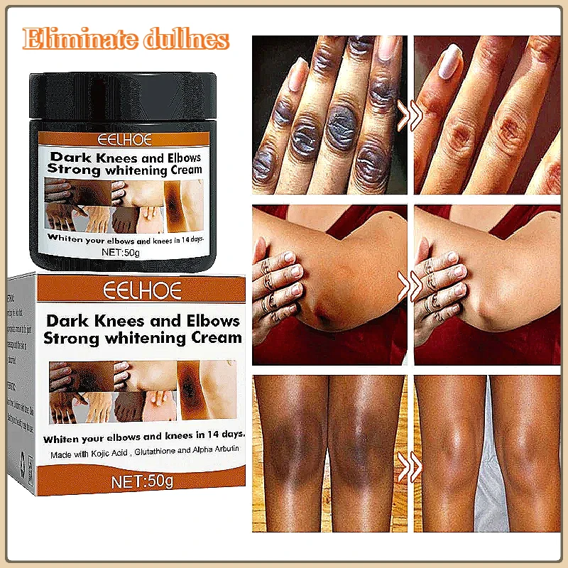 Dark Colored Quick Whitening Cream Skinpowerful Stain Remover Knuckles Correction for Dark for Knuckles Elbows and Knees