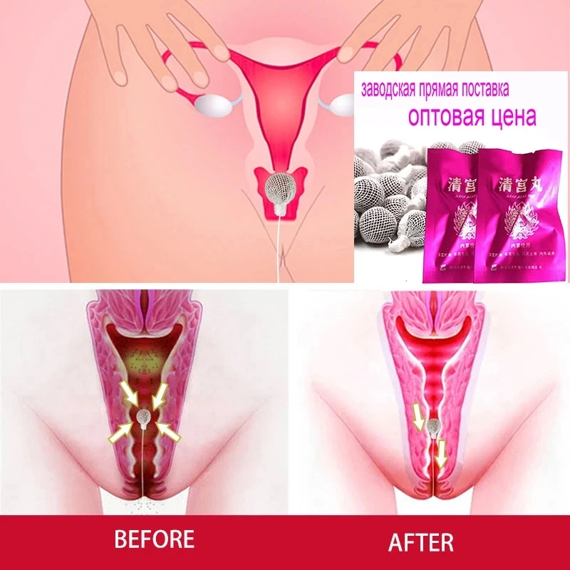 Beautiful life tampons swab vaginal clean point tampon discharge toxins gynaecology pads feminine hygiene product 10pcs/lot vaginal detox tampons