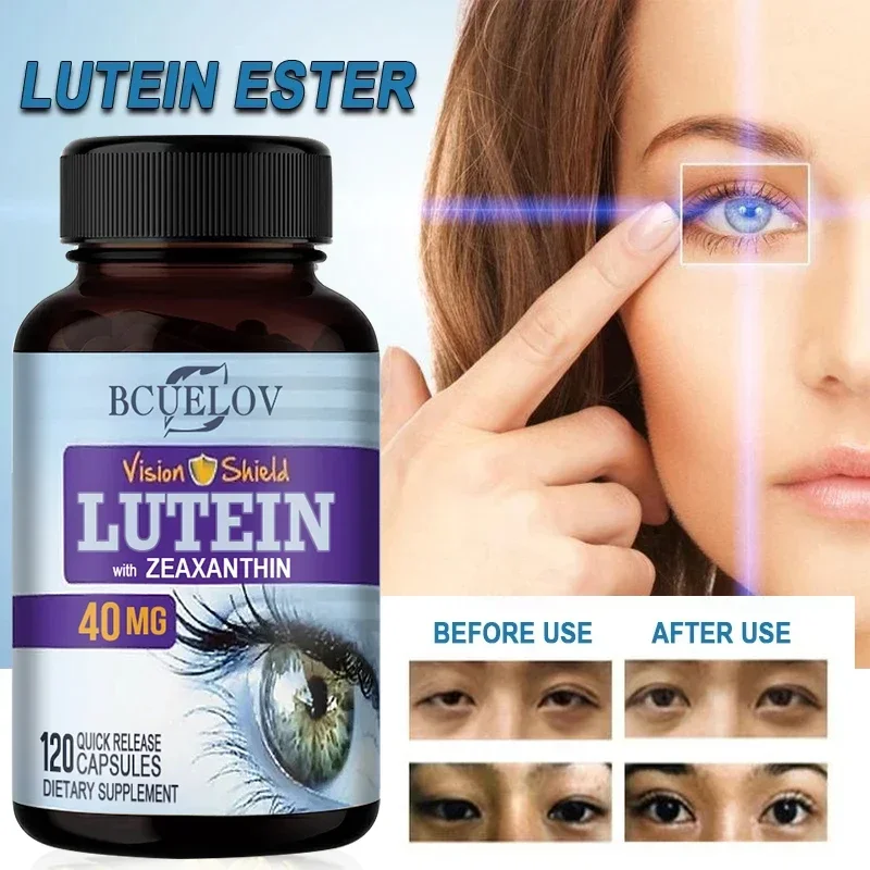 

Eye Vitamins - Adult Eye Supplement - with Lutein - Supports Healthy Vision, Daily Eye Fatigue and Occasional Dry Eyes