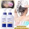 EHD Anti Hair Loss Shampoo Oil Control Fluffy and Smooth Deep Cleansing Ginger Hair Growth Shampoo Soothes Hair Follicles 500ml 1