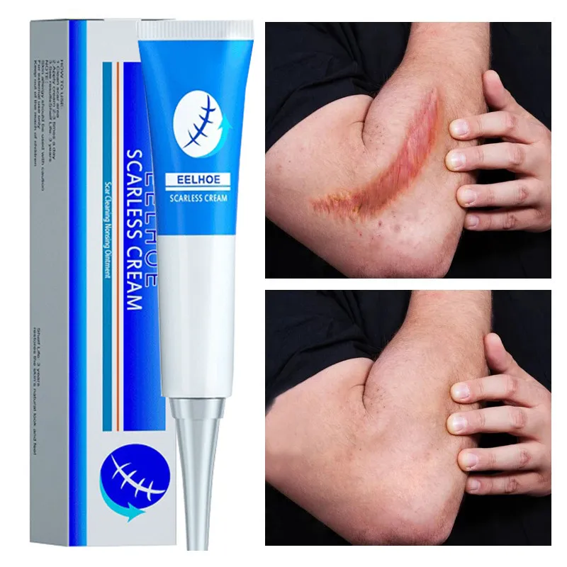 Scar Removal Cream Gel Effective Repair Surgical Scars Stretch Marks Acne Pits Pockmarks Burn