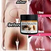 Body Whitening Cream Private Parts Underarm Bleaching Serum Whiten Butt Knee Brighten Inner Thigh Intimate Dark Remove Melanin 1
