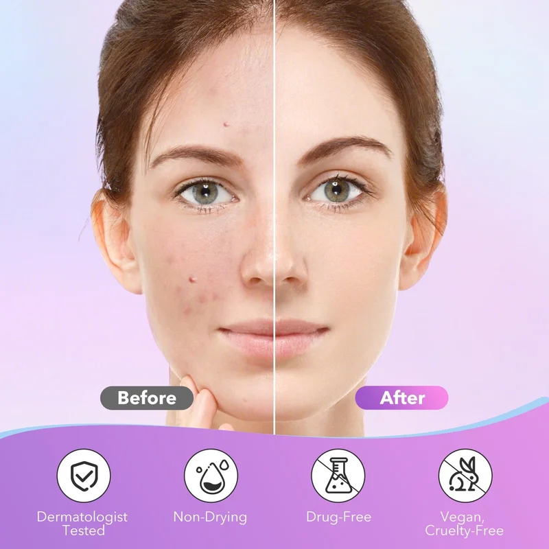 1680 Acne Patches