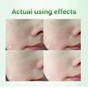 Salicylic Acid Pores Shrink Cream Refining Large Pore Improve Face Acnes Blackhead Remove Cream Anti-aging Oil Control Skin Care 2
