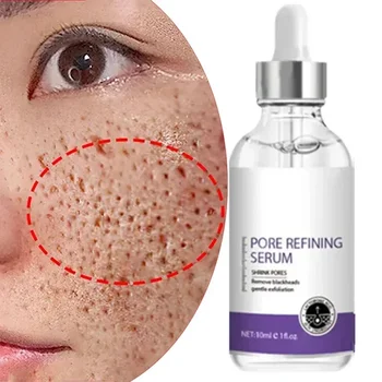 Texture della pelle | Resurfacing per il rafforzamento dei pori, siero viso schiarente con retinolo e niacinamide non comedogenico