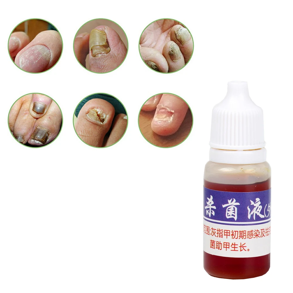 Nail Fungus Remover Anti Infection Fungal Nail Treatment Liquid Gel