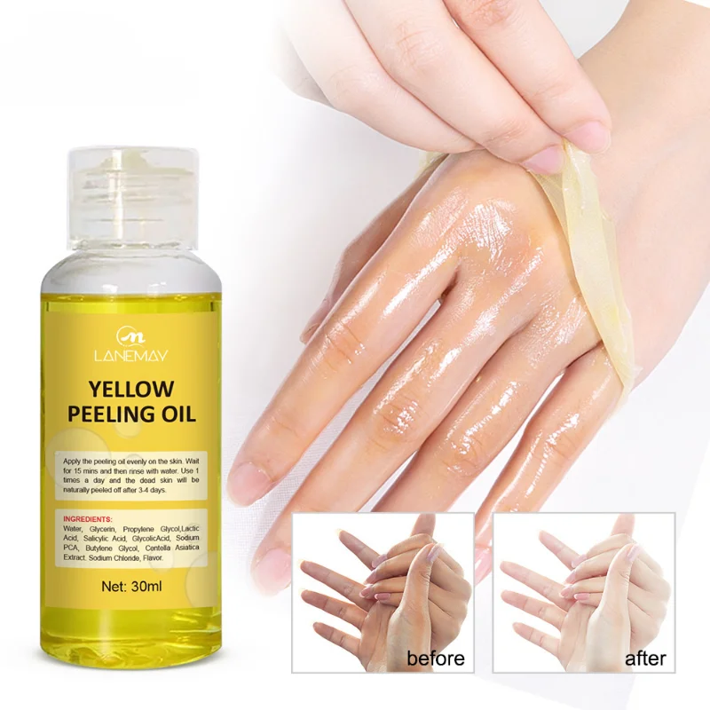 

Sdotter Yellow Exfoliating oil whitening body skin Peeling removal dead skin Dilutes Dark Spot Melanin Moisturizing brightening