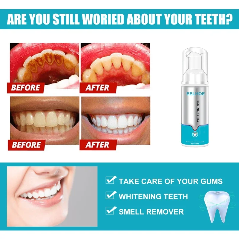 Dental Calculus Remover Whitening Teeth Mouth Odour Removal Bad Breath Preventing Periodontitis