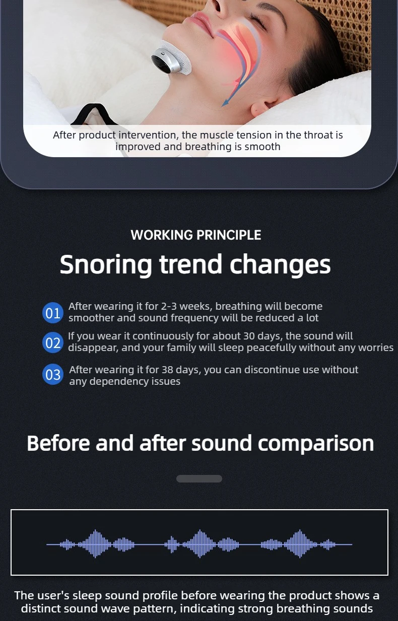Anti-Snore Device with Dual-Pulse Stimulation - Sleep Apnea Relief, Snore Reduction, Muscle Trainer for Silent Night