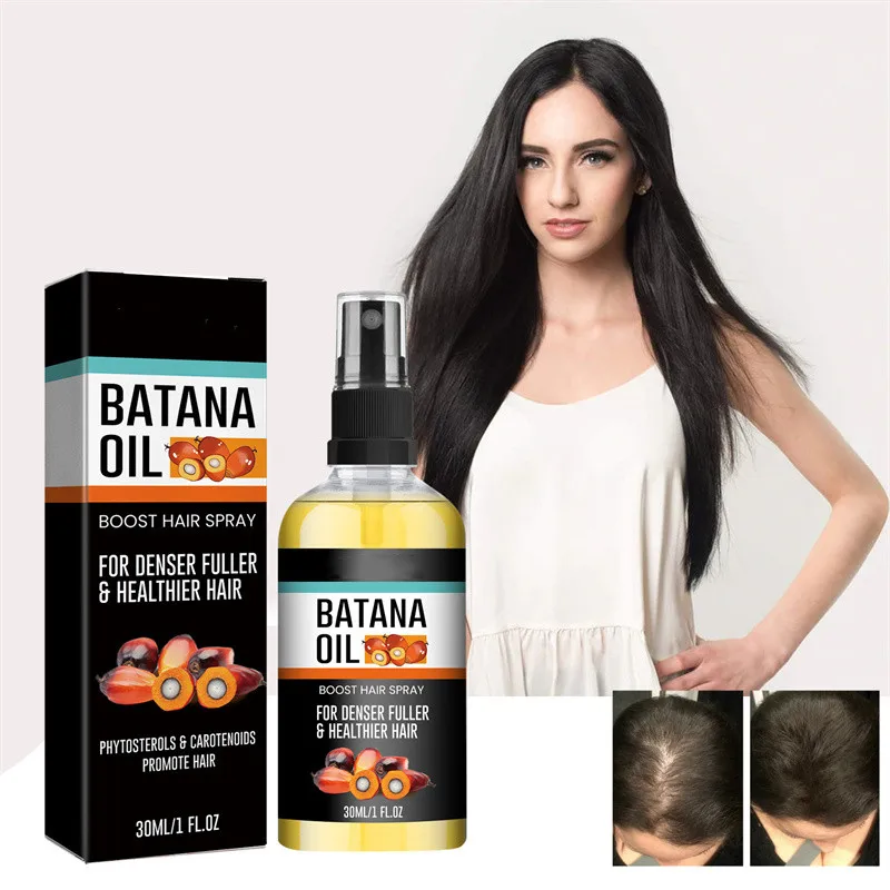 30ML Batana Oil Hair Growth Oil for Men Women Anti Hair Loss Scalp Treatment Serum 7 Day Fast Regrowth Care Growth Products