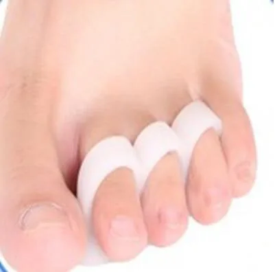 1 external correction device for repairing toe and toe separator toe separator toe separator