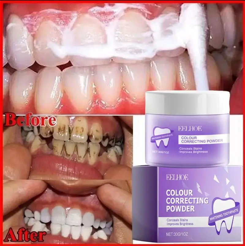 5 Days Teeth Whitening Powder Remove Plaque Stains Dental Calculus Oral Hygiene Tooth Care
