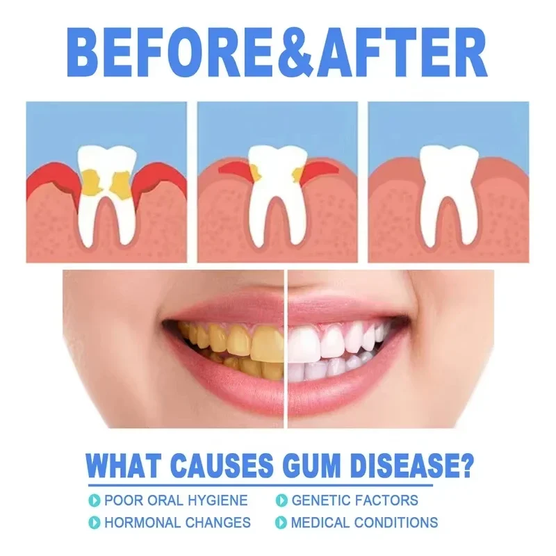 21 Rapid Repair Gums Serum Effectively Relieve Tooth Allergy Dental Caries Tooth Cleaning Toothpaste Relieve Damage Drops