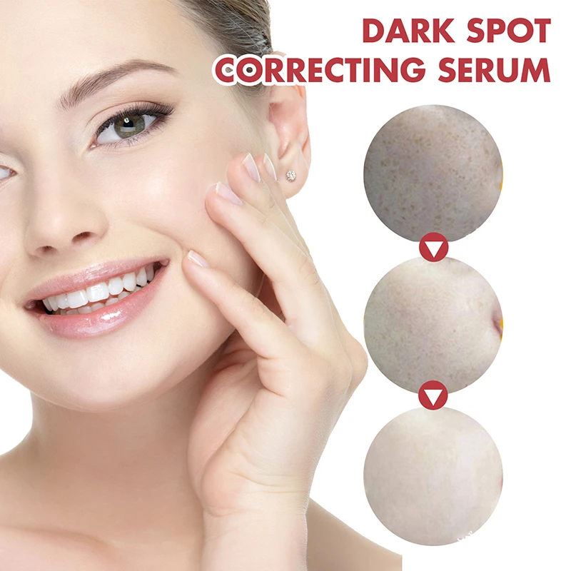 Dark Correcting Essence 10% Niacinamide+ 4% Tranexamic For Post-Acne Marks Acne Hyperpigmentation Even Skin Tone Serum facial essence