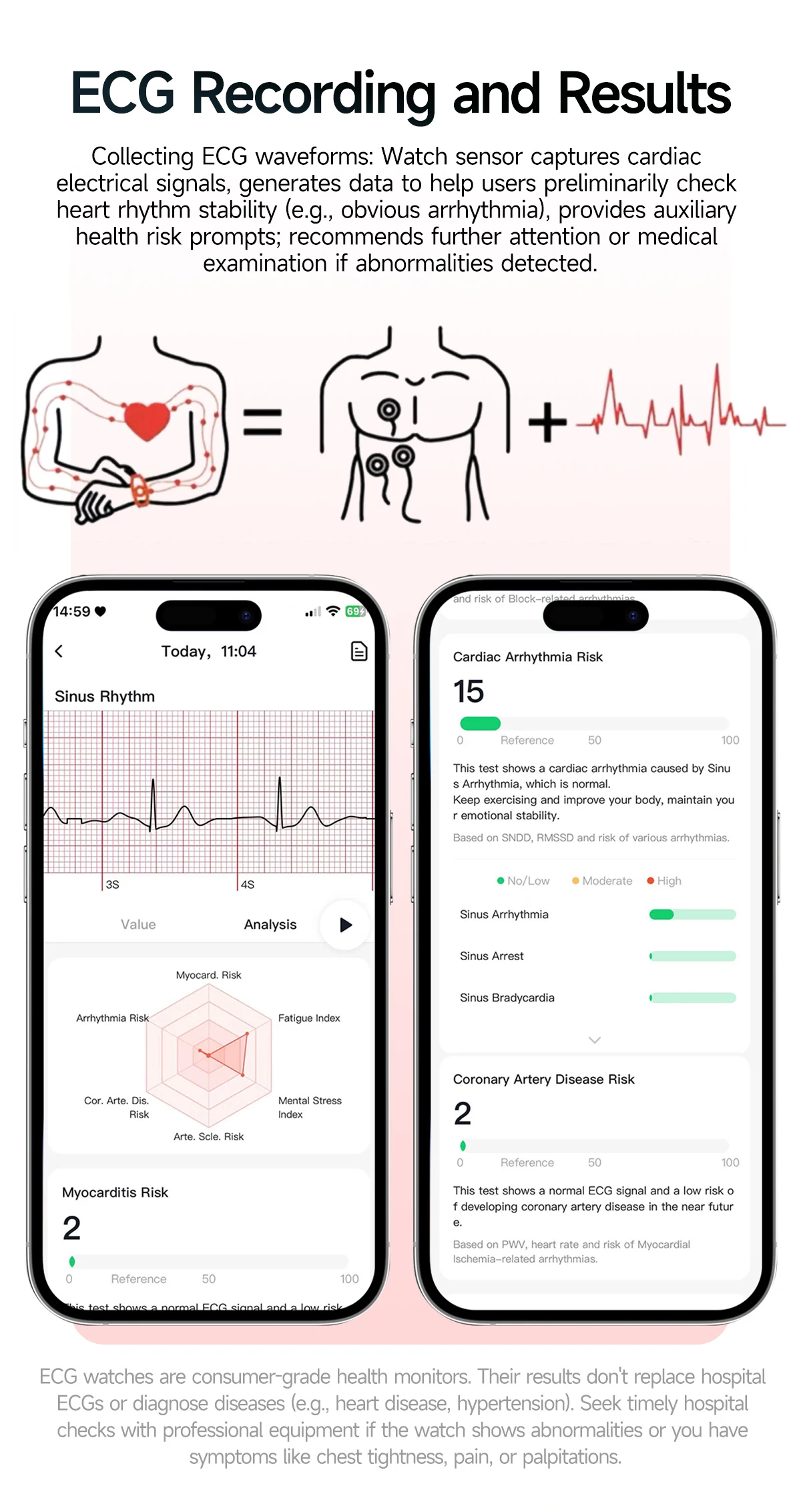 Smartwatch dames ecg bmi lichaamsvet analyse bluetooth bellen_voghion.com
