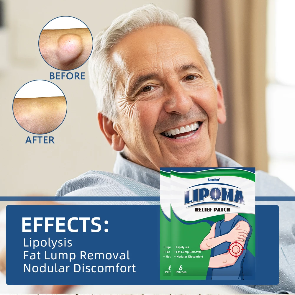 6/18/30Pcs Sumifun Lipoma Removal Patch Reduce Inflammation Subcutaneous Mass Relieve Pain Sticker Fat Lump Nodular Care Plaster