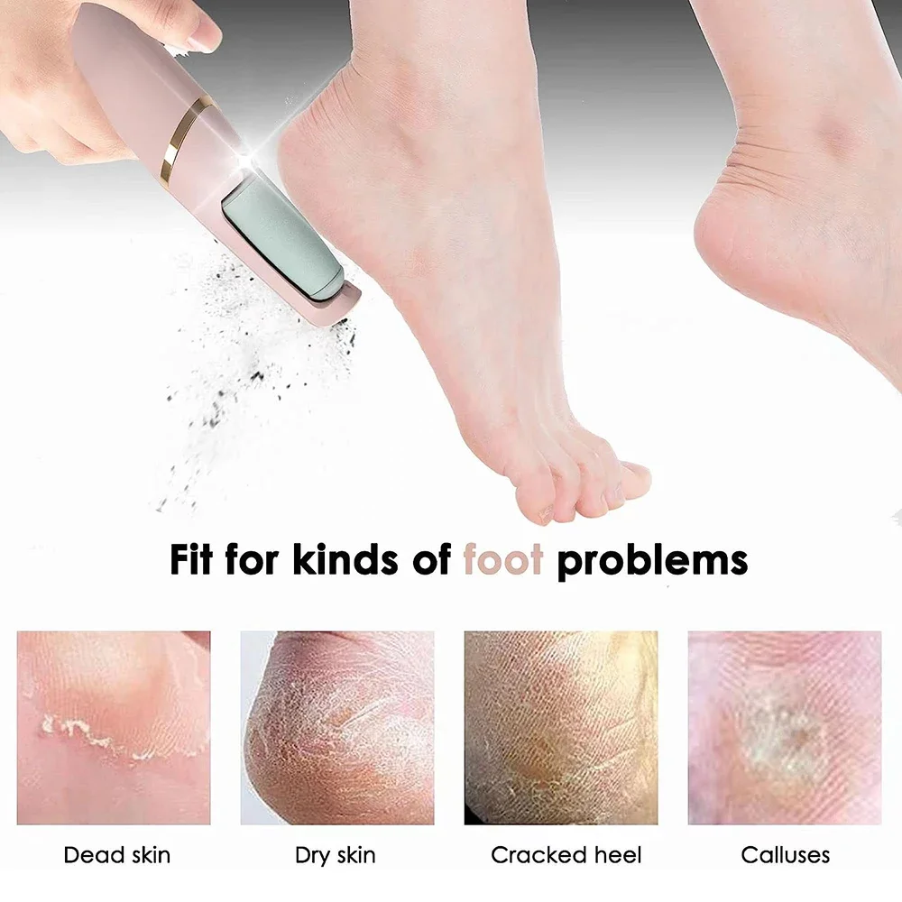 Electric Foot Callus Remover Electric Foot Callus Remover Rechargeable Scrubber Grinder Professional Pedicure Feet Care