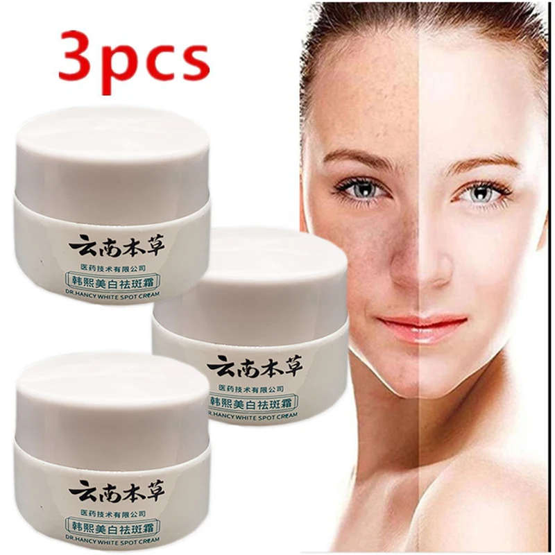 

Whitening Freckles Cream Remove Melasma Dark Spot Lightening Melanin Removal Melasma Remover Moisturize Brighten Face Skin Care