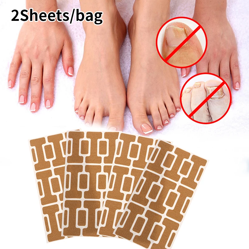 

2Sheets Nail Treatment Patch Anti Infection Paronychia Onychomycosis Ingrown Toe Nails Groove Fungus Correction Repair Sticker