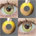 ANIME Yellow
