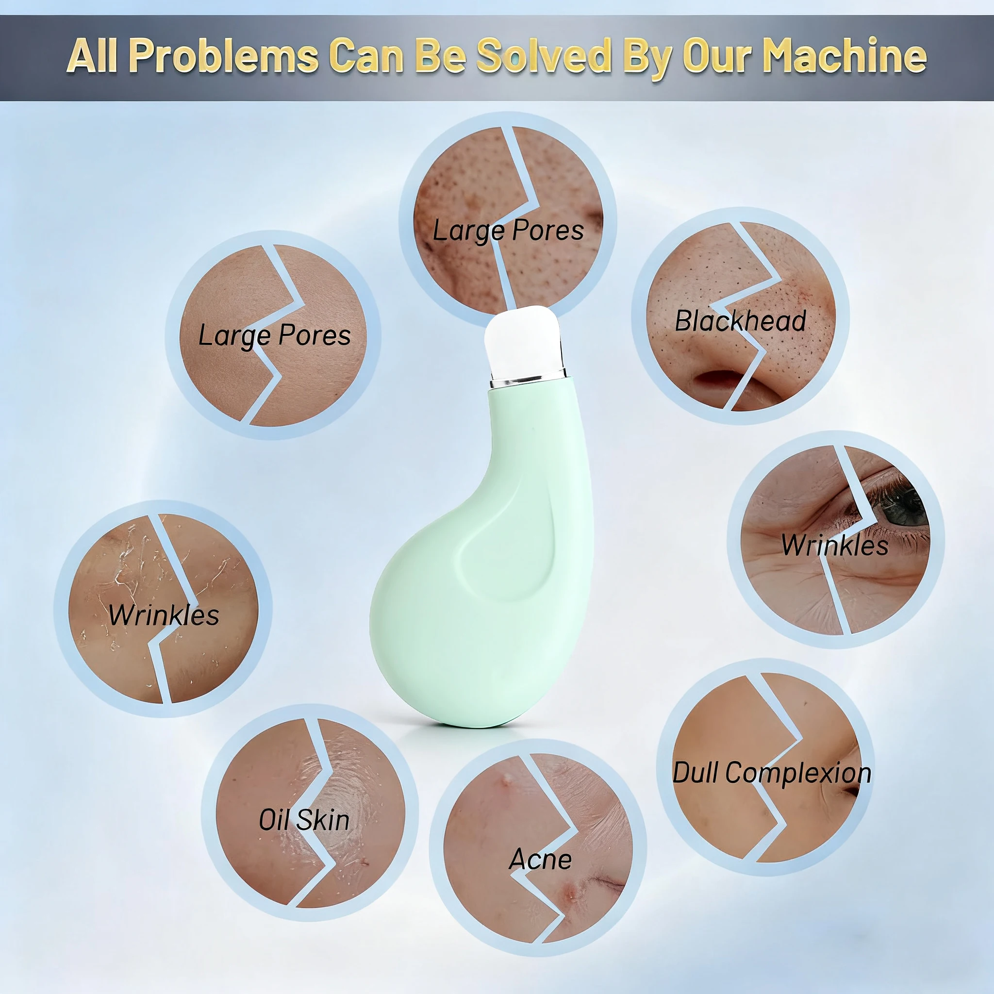 Remove Blackhead Skin Scrubber Ance Pore Cleaner Peeling Blackhead Remover Deep Face Cleaning Ion Facial Shovel Cleanser