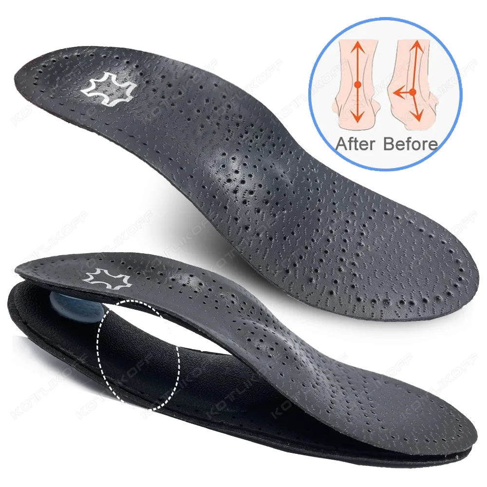 KOTLIKOFF Leather Orthotic Insole Flat Arch Support Orthopedic Shoes Sole Insoles For Feet Men Women O/X Leg Corrected_voghion.com