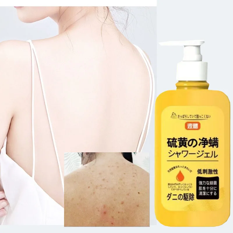 Sulfur mite-removing bath lotion cleans controls oil Moisturizing improve dark yellow skin eliminates mites inhibits bacteria