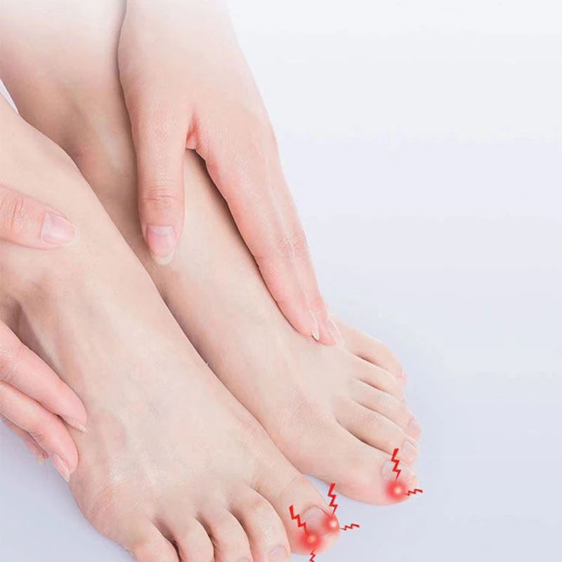 Ingrown Toenail Corrector Tools Pedicure Recover Embed Toe Nail Treatment Professional Ingrown Toenail Correction Foot CareTool toe corrector foot care tool ingrown toenail correction tool foot pedicure tool mens foot care product