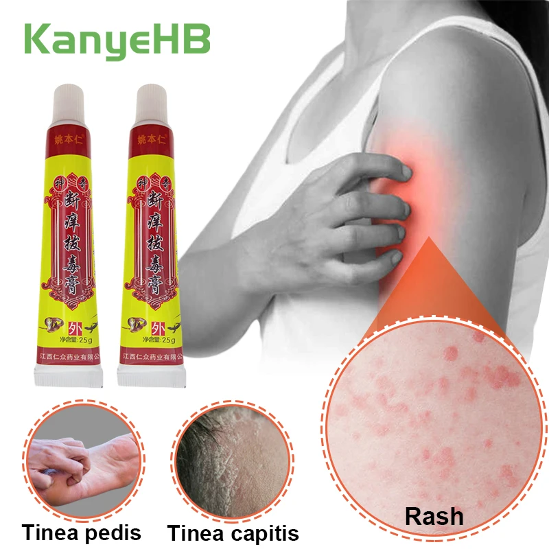 

2pcs Herb-medicine Skin Disease Treatment Cream Allergy Dermatitis Ointment Mosquito Bites Rash Eczema Cream Hormone Free A253